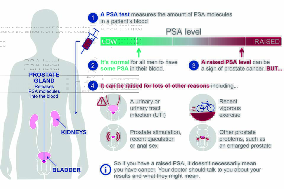 Guidance updated on PSA testing for prostate cancer PHE Screening
