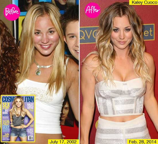 Kaley Cuoco Boob Job Before and After Plastic Surgery Facts