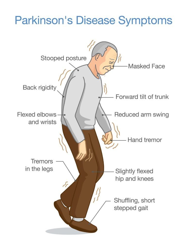 Possible Skin Test for Detecting Parkinson's Disease Premier