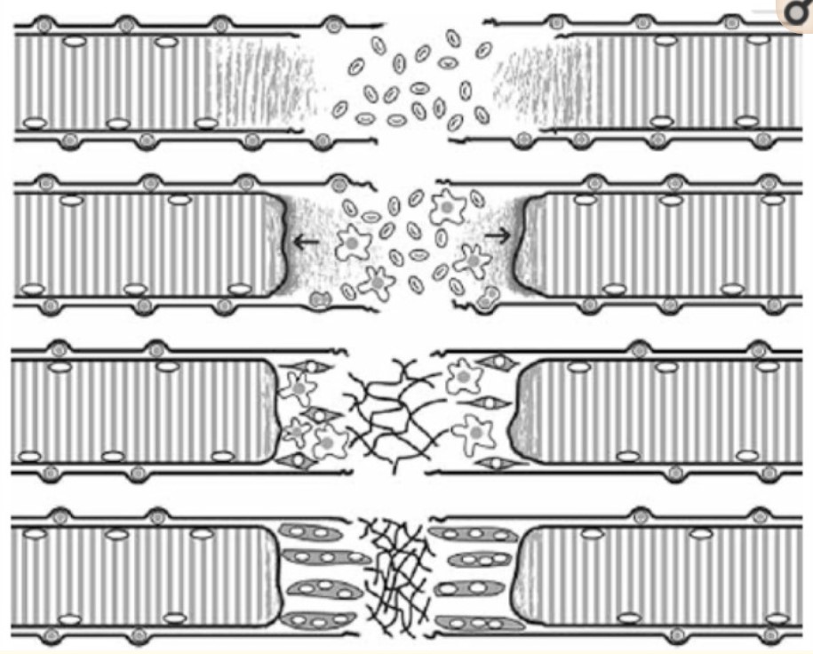 Muscle Repair Diagram
