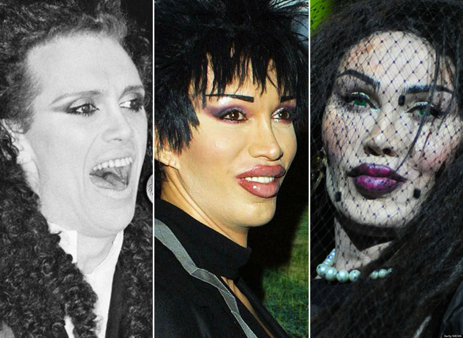 Pete Burns Surgery The Changing Face Of The Dead Or Alive Singer