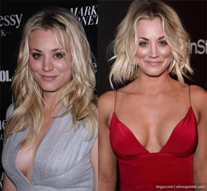 Kaley Cuoco Breast Implants Kaley Cuoco Plastic Surgery Pinterest Kaley cuoco, Plastic and