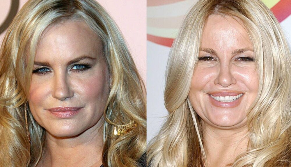 Jennifer Coolidge Breast Implants