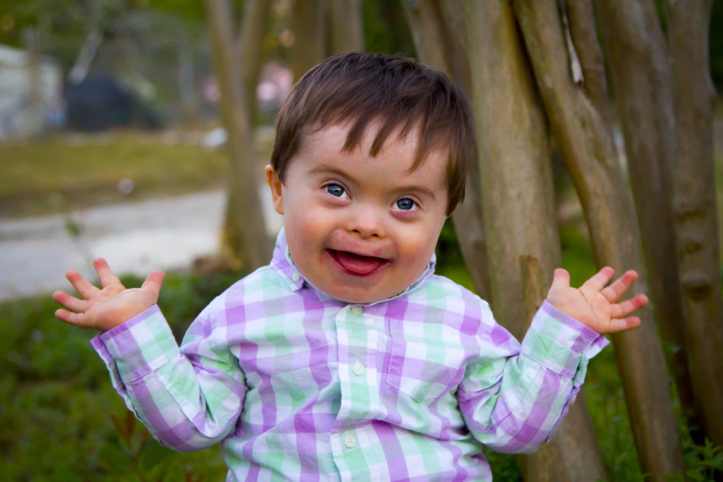 What is Down Syndrome? Shreeansh Fetal medicine center
