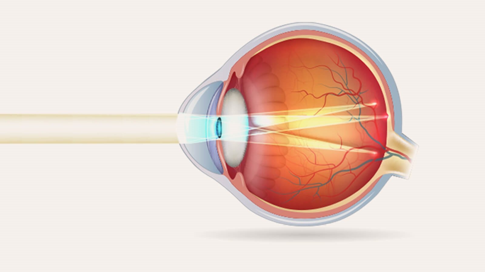 Why does astigmatism affect our night vision?