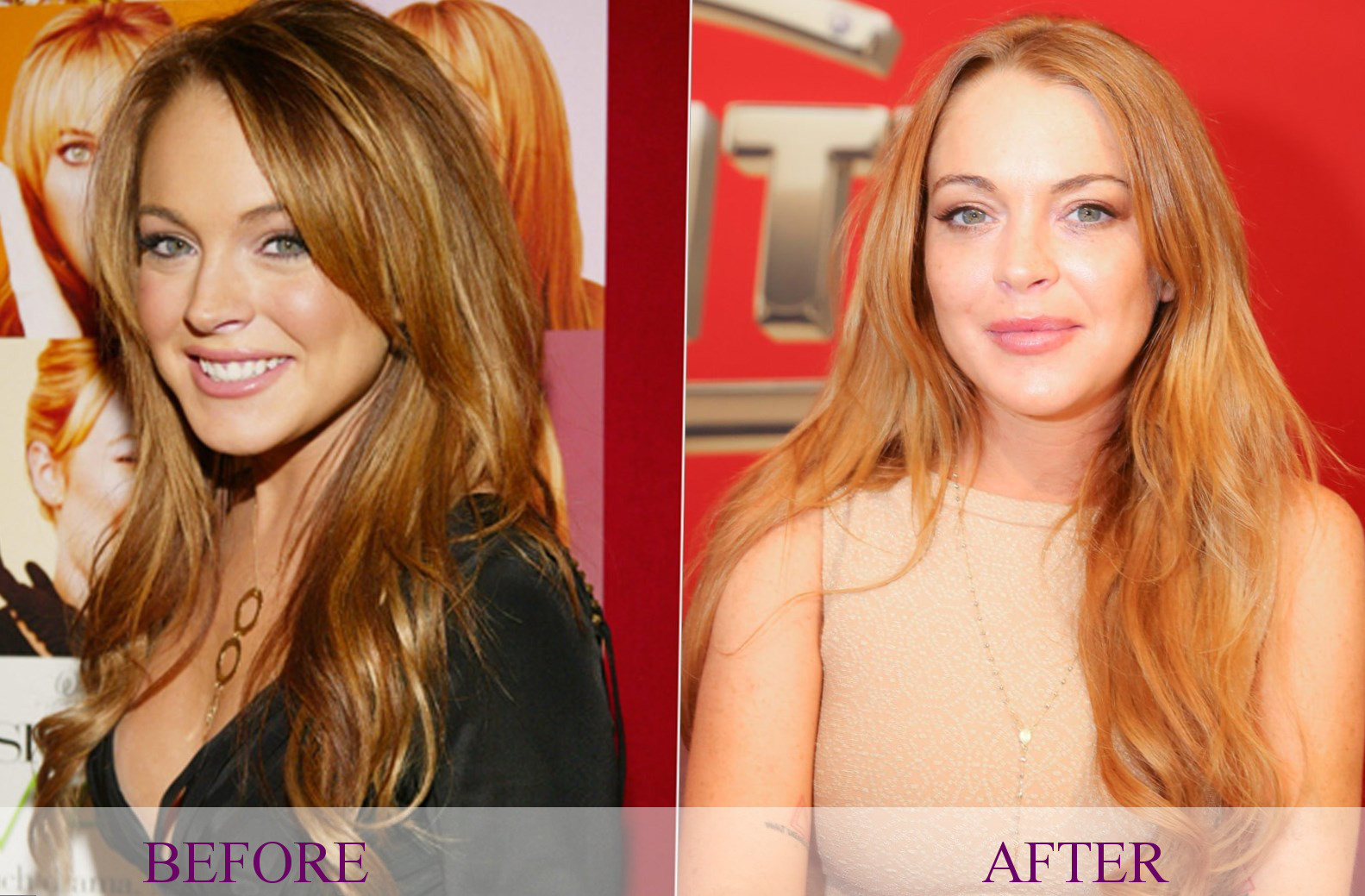 Celebrity Lindsay Lohan plastic surgery, photos, video