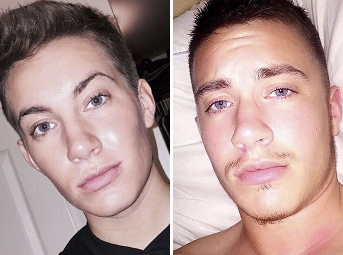 Transgender Man Shares Incredible Before & After Progress Photos, Loses