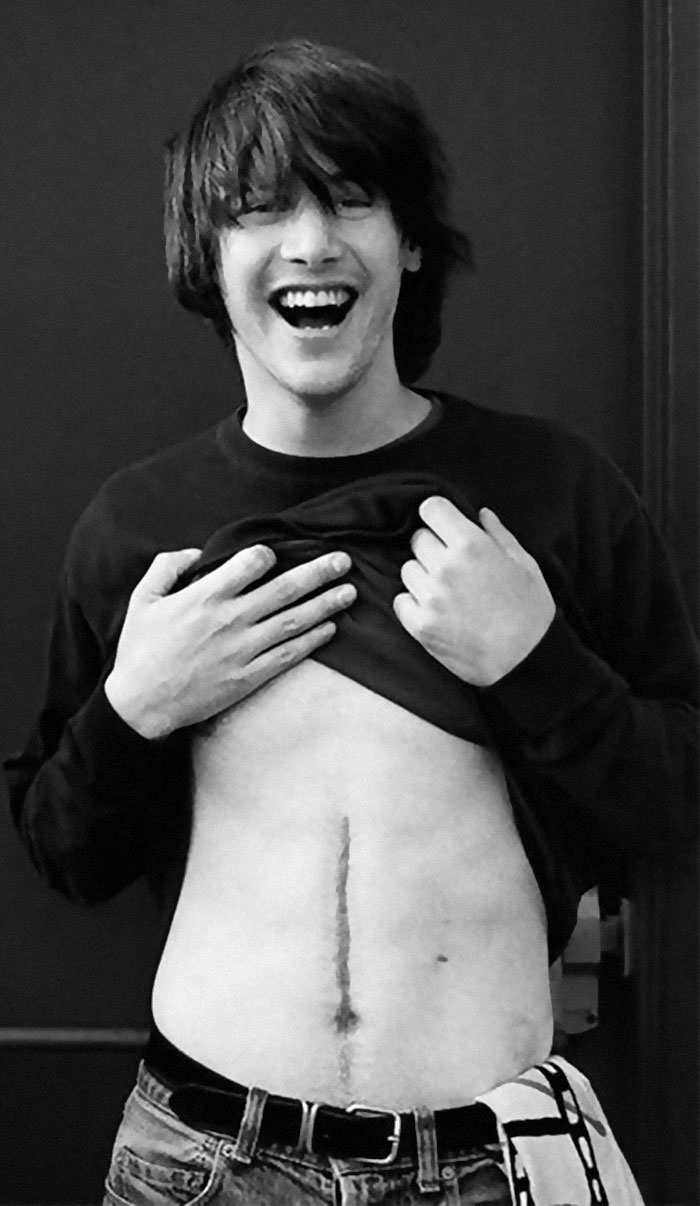Celebrities That Have Visible Scars Share Stories Behind Them Bored Panda