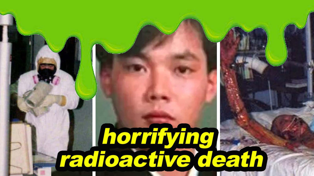 'Most radioactive man' Hisashi Ouchi was kept alive for 83 days after