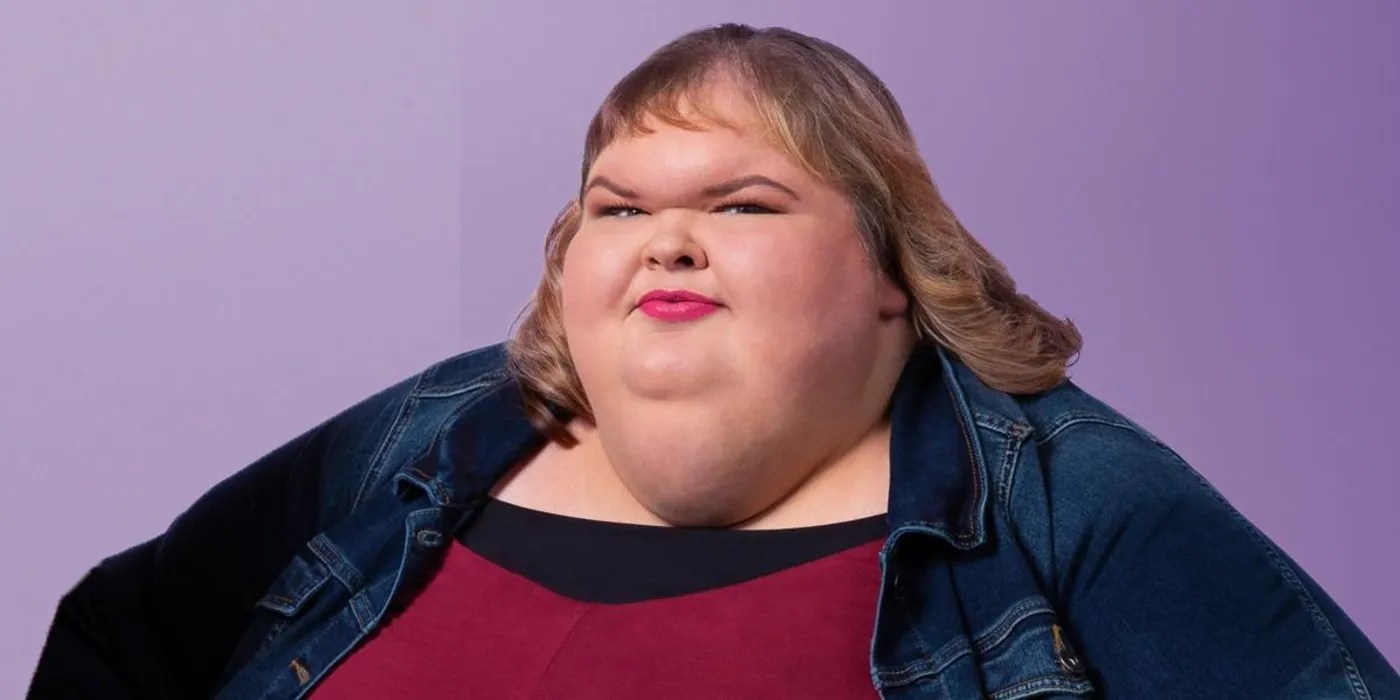 1000Lb Sisters Why Tammy's Skin Removal Surgery Is Exciting