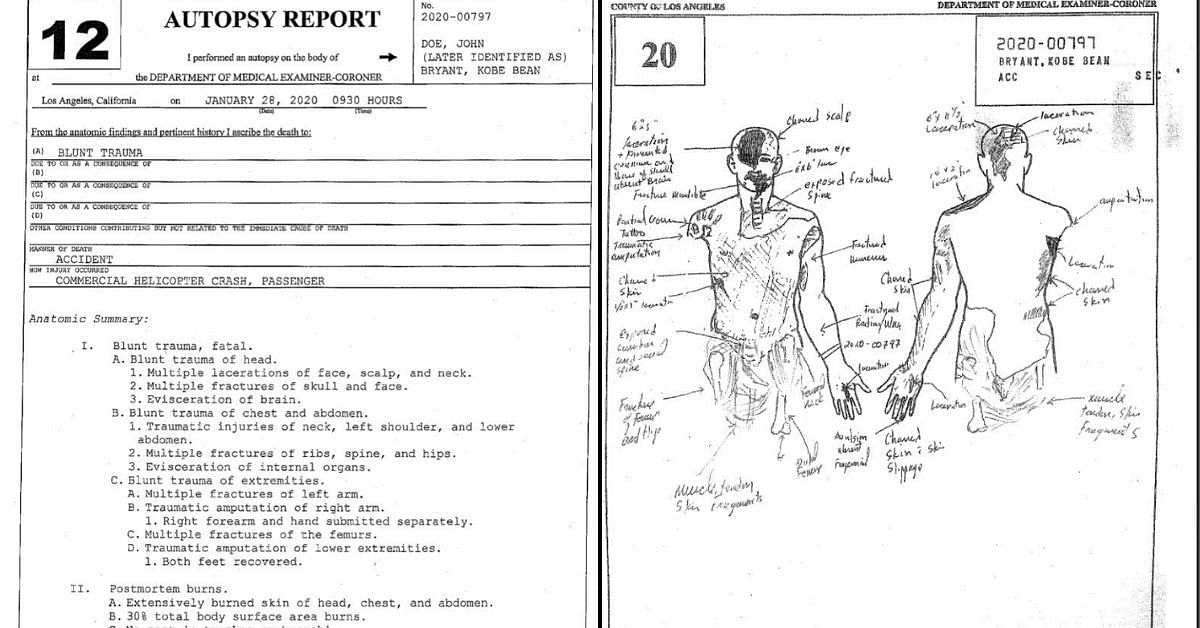 What were the findings of Kobe Bryant’s autopsy report? Looking at