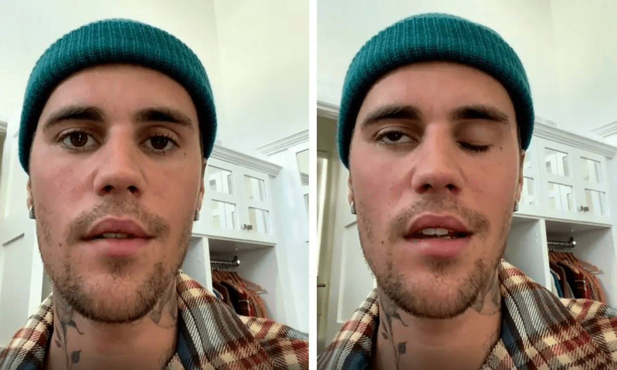 Justin Bieber cancela gira mundial después de sufrir otra vez parálisis