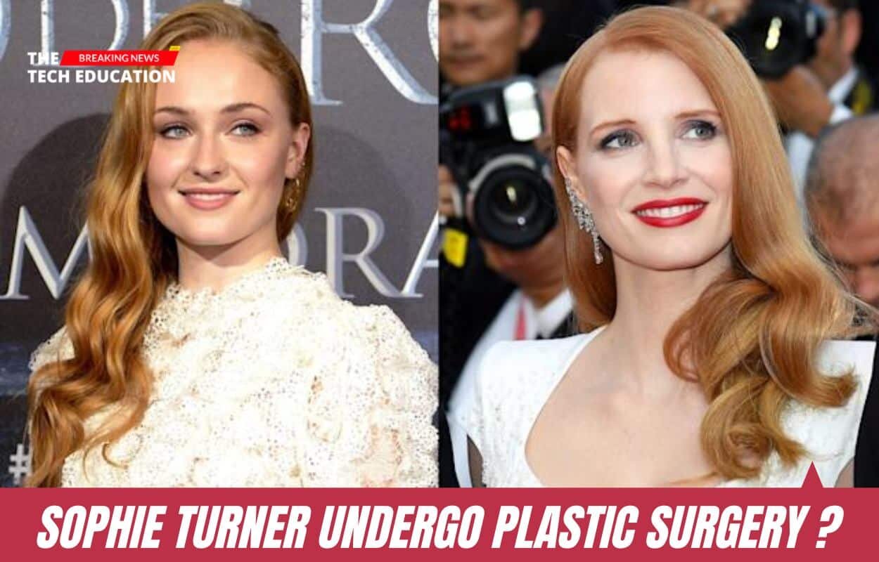 Did Sophie Turner Undergo Plastic Surgery Or Rumors? Learn All The