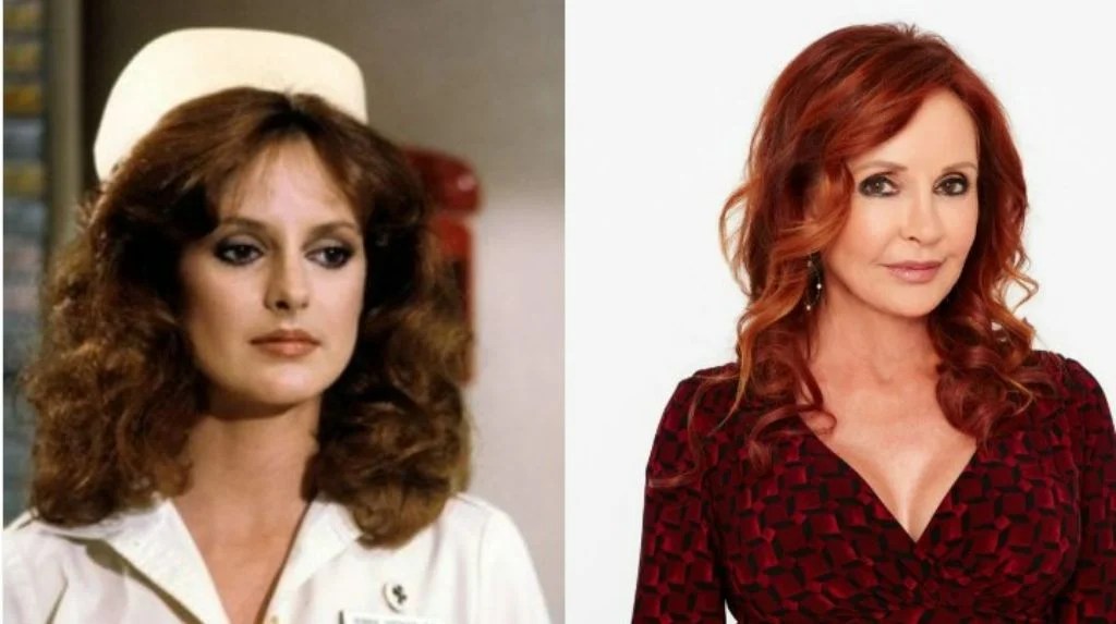 Bobbie Spencer Plastic Surgery Before And After Photos