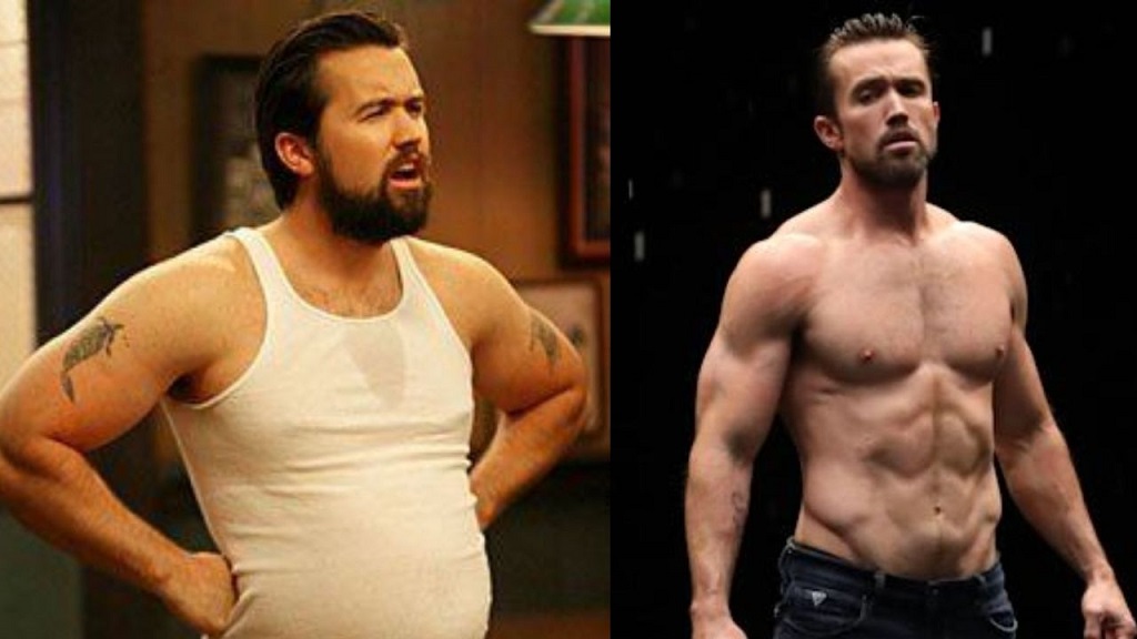 Rob McElhenney Plastic Surgery Before And After Photos