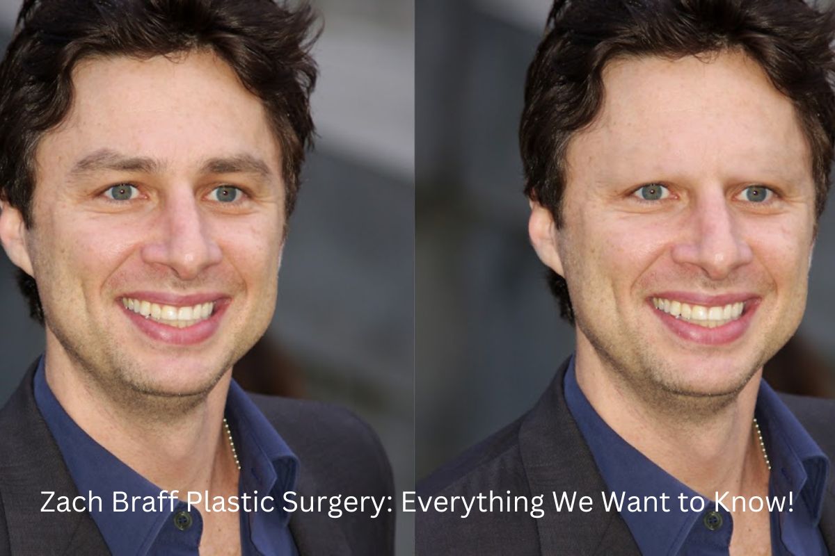 Zach Braff Plastic Surgery Everything We Want to Know! United Fact