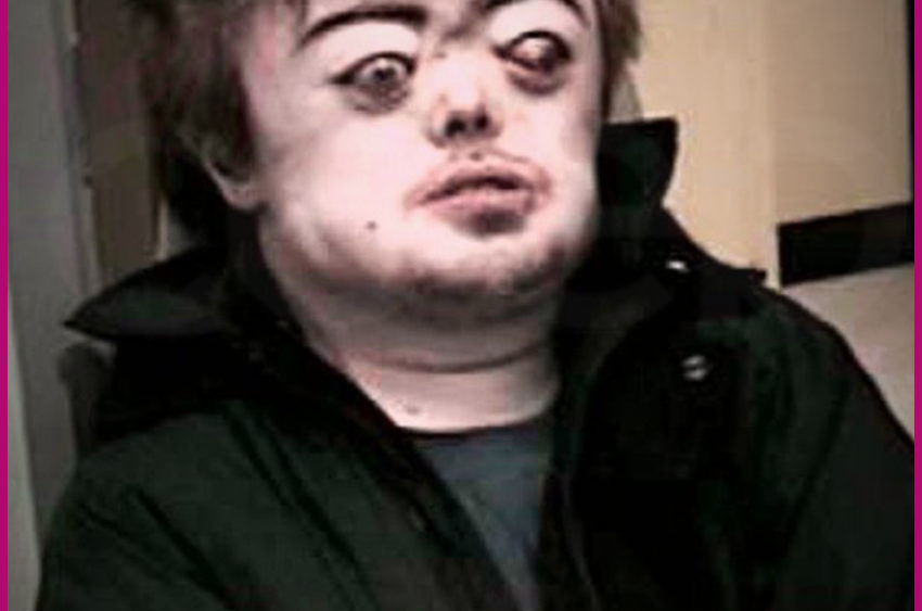 Brian Peppers The Scandal of a Sex Offender and Crouzon Syndrome Sufferer