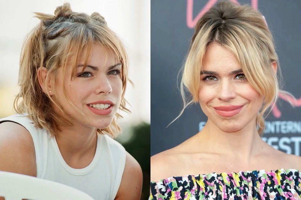 Billie Piper Botox Before And After Plastic Surgery Photos