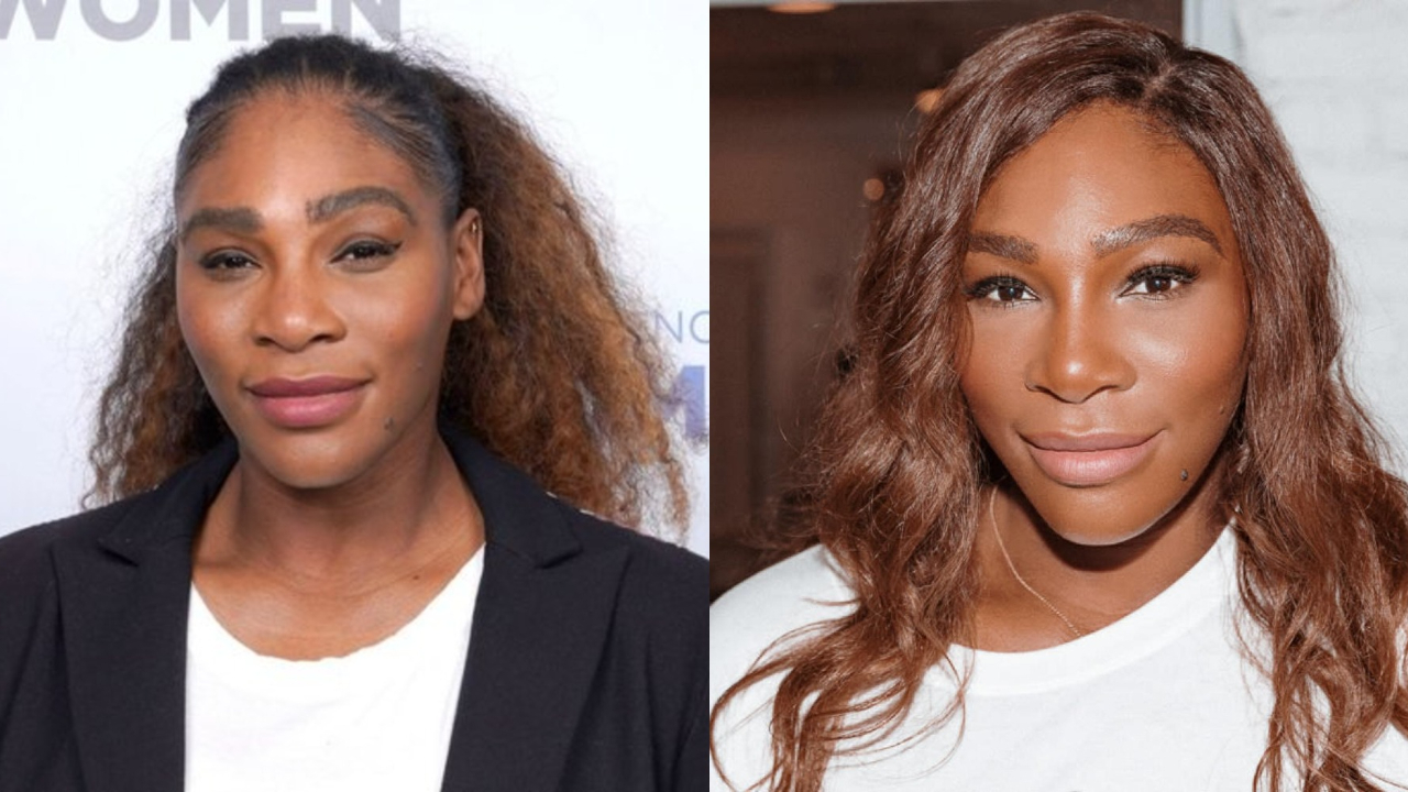 Serena Williams' Plastic Surgery The Complete Breakdown!