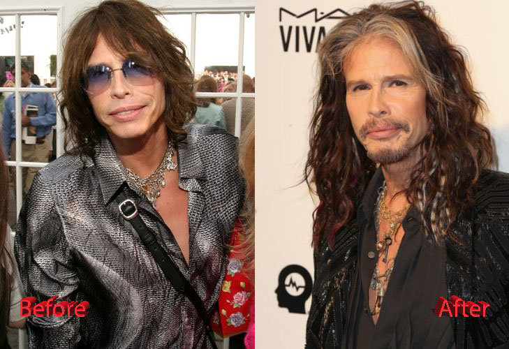 How Far Will Steven Tyler Go With Plastic Surgery?