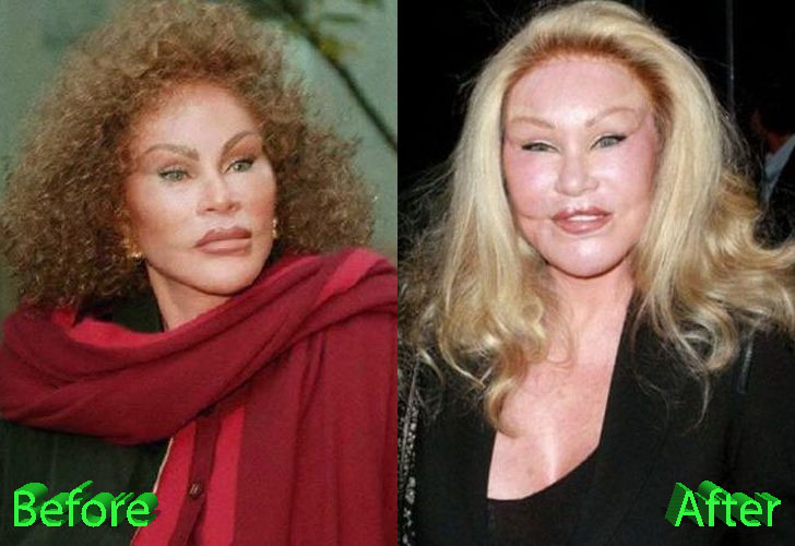 Catwoman Plastic Surgery From Bad To Worse