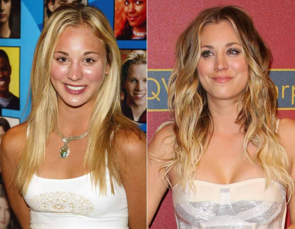 Kaley Cuoco Breast Implant Plastic Surgery Before And After Photos 2018 Plastic Surgery before