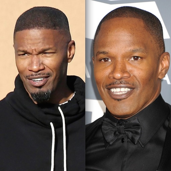 Jamie Foxx Hairline Surgery Before And After Photos 2018 Plastic