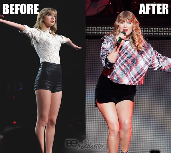 Taylor Swift Plastic Surgery Mystery SOLVED!