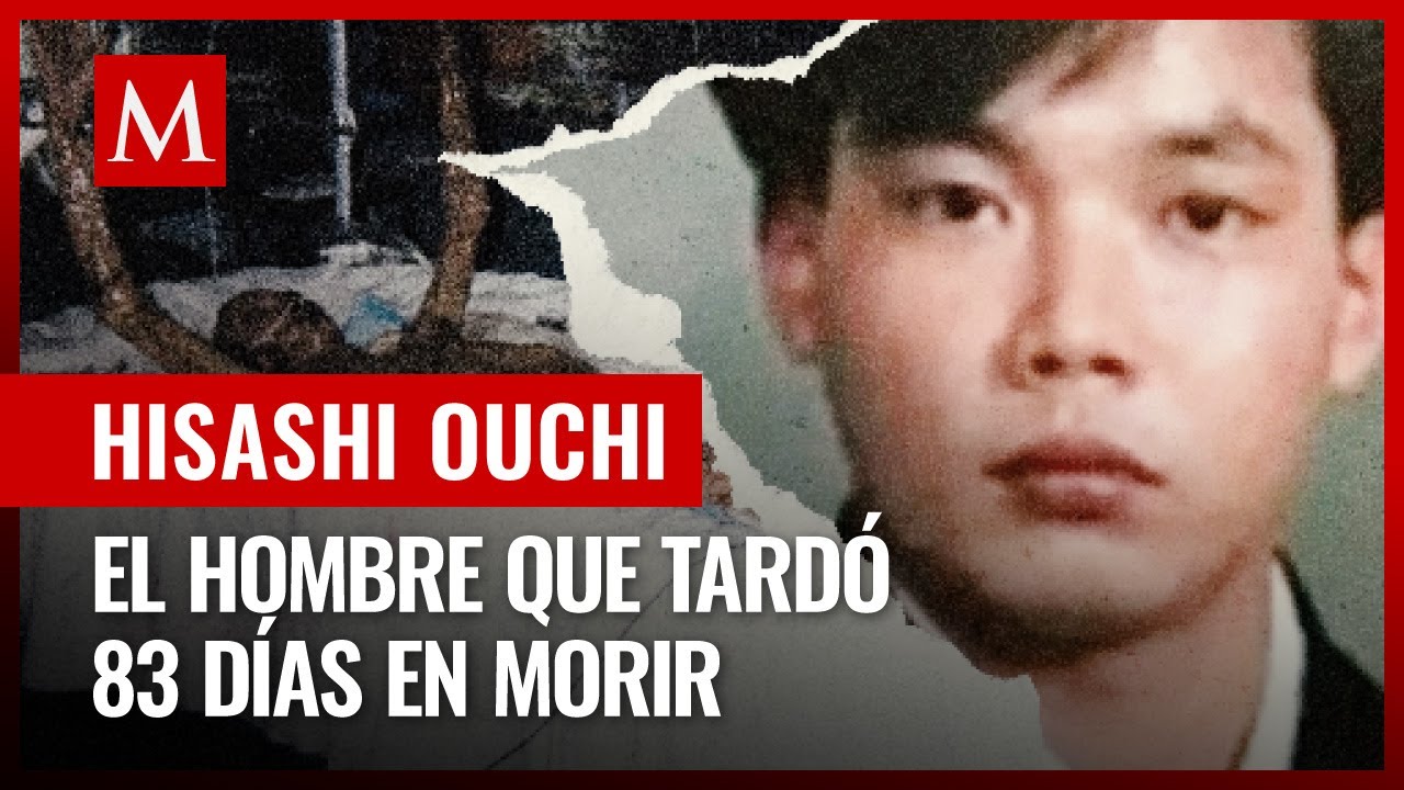 La trágica historia de Hisashi Ouchi, el hombre que sufrió la mayor