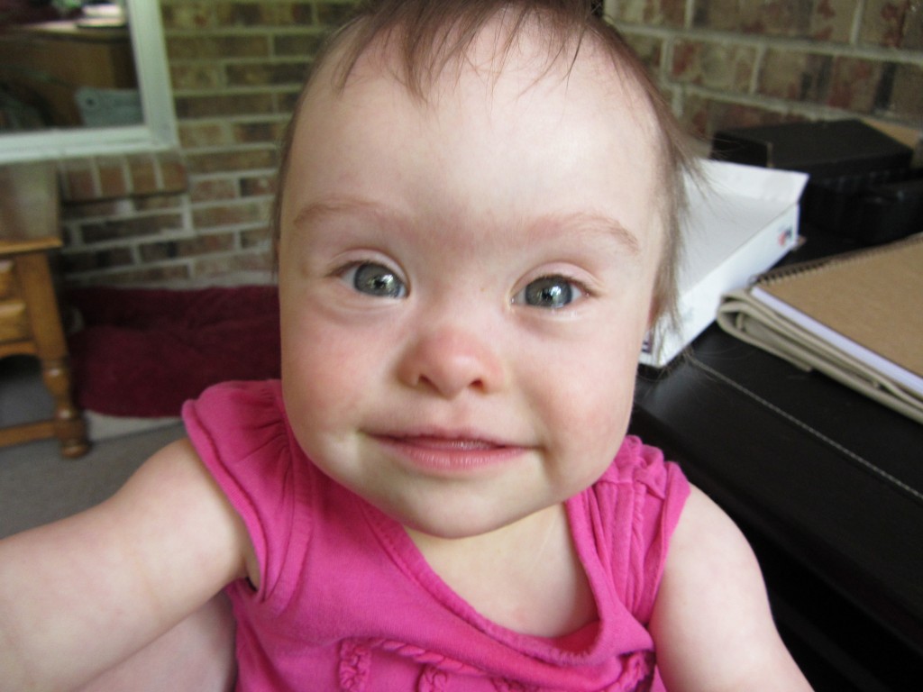 Things to Know About Down Syndrome Physical Traits Carrie with Children