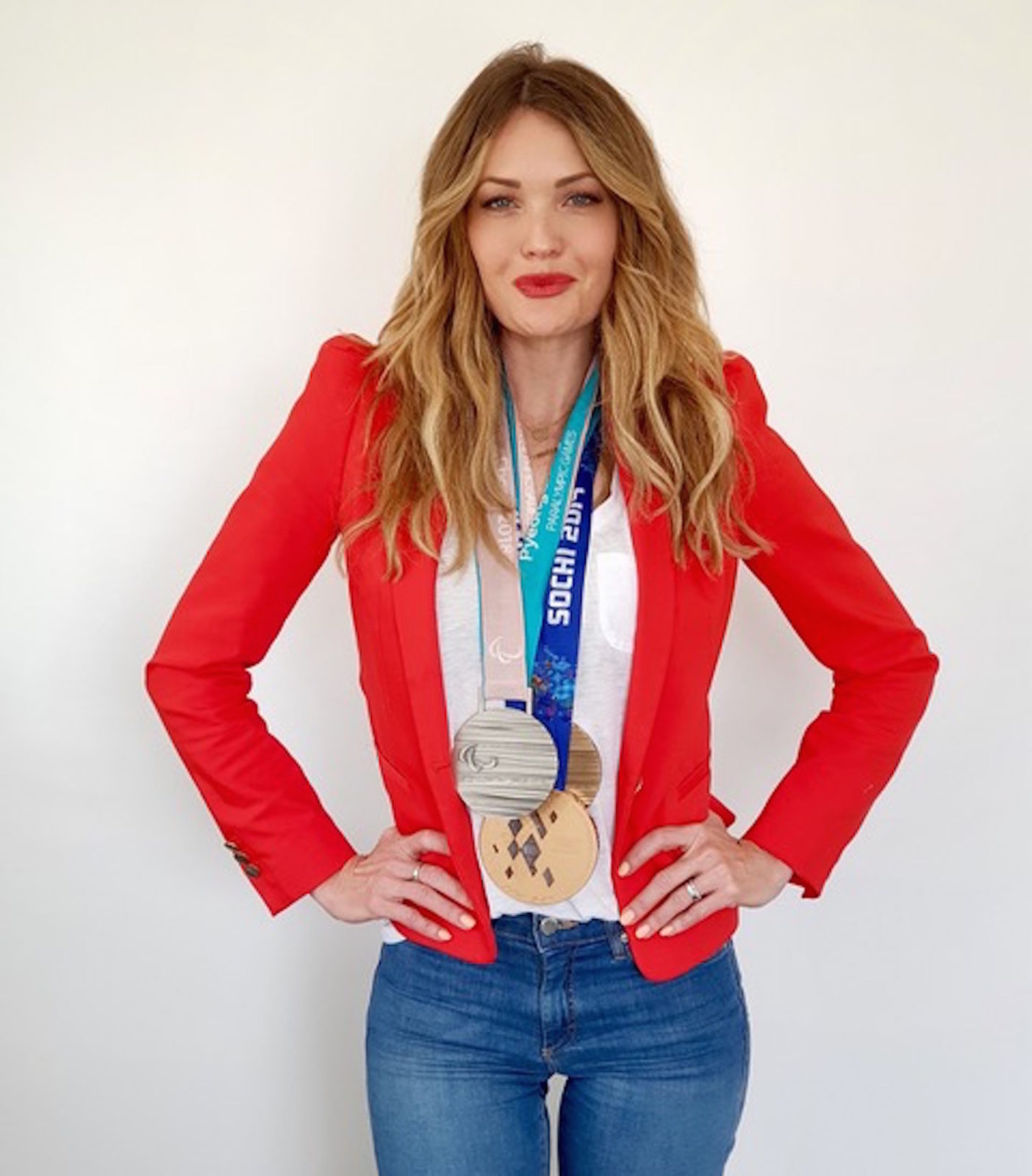 Amy Purdy's Story of the Hardest Challenges, Winning