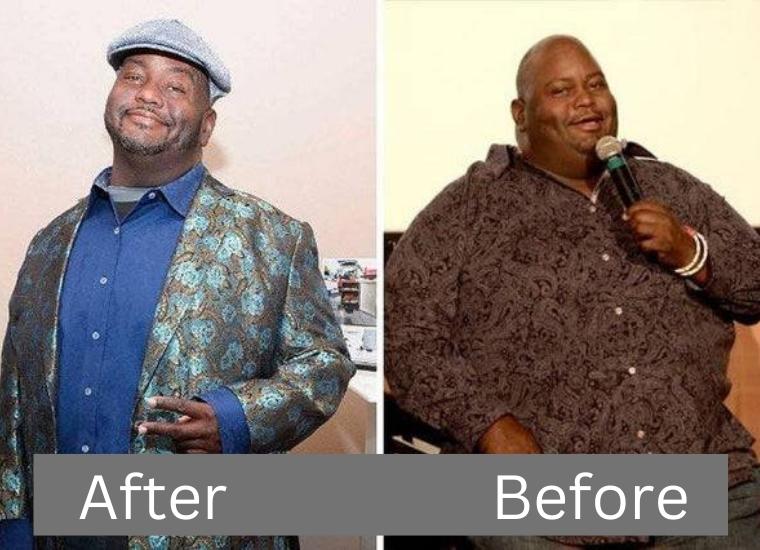 Lavell Crawford's Weight Loss 2022 Diet, Surgery, Before & After