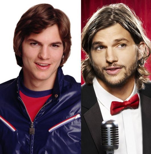 Ashton Kutcher before and after plastic surgery (21) Celebrity