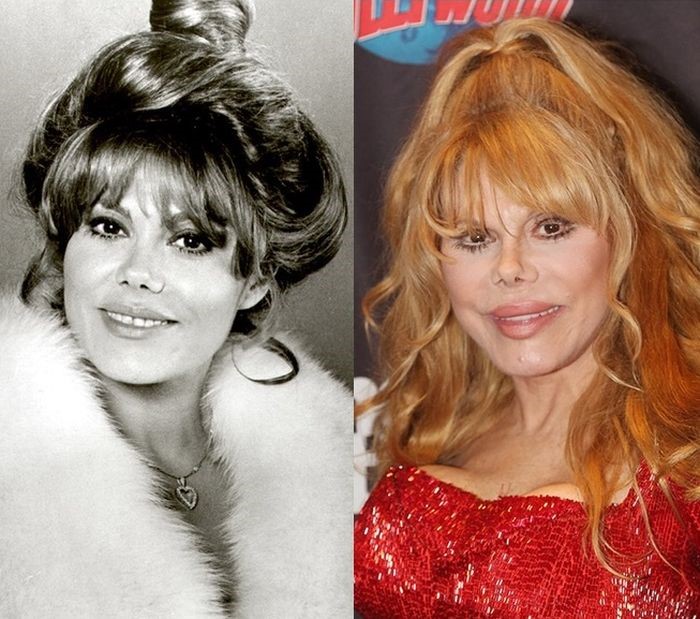 Charo plastic surgery beauty in old age