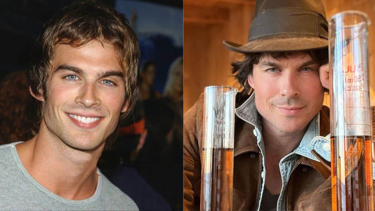 Ian Somerhalder Before and After Plastic Surgery