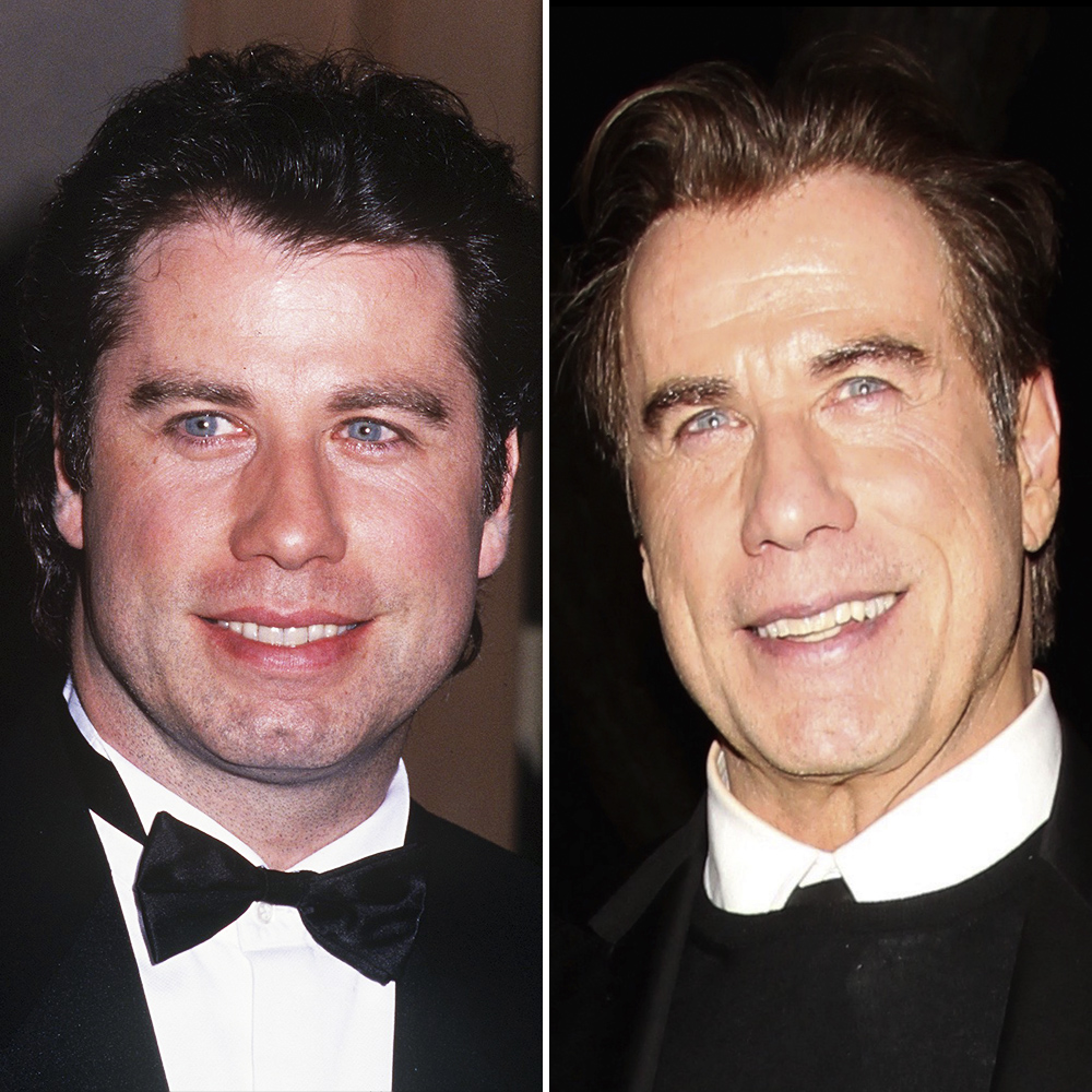 Did John Travolta Have Plastic Surgery? See His Changing Looks Through