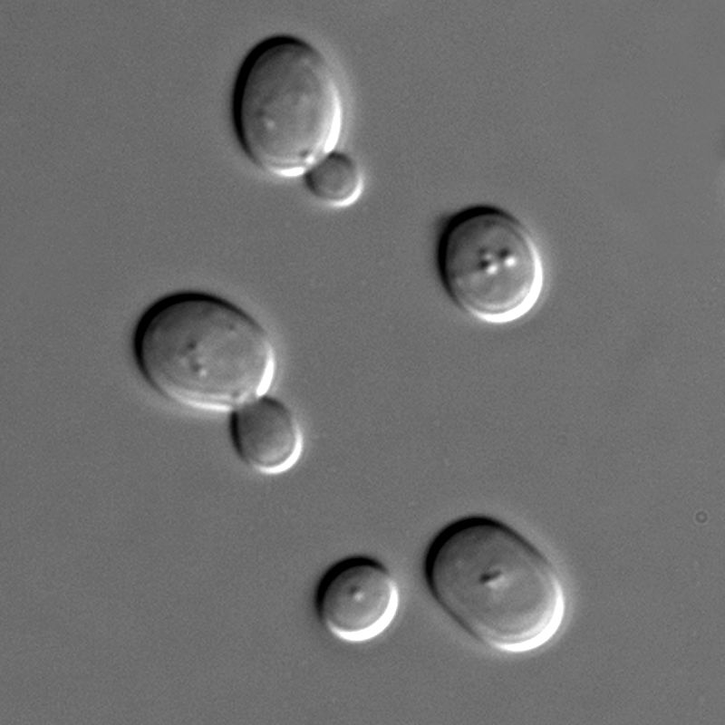 Key Difference Between Molds and Yeasts