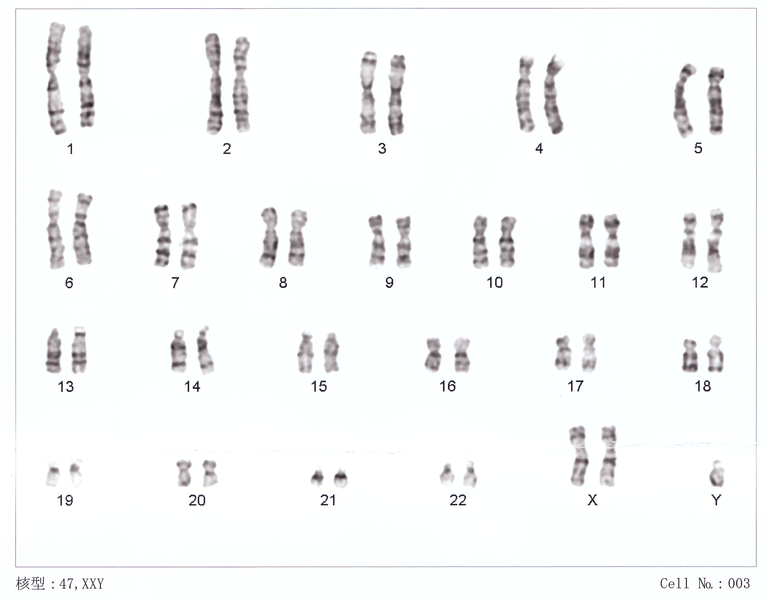 Difference Between Aneuploidy and Polyploidy