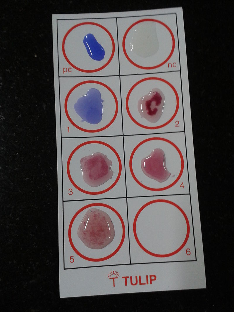 serology vs. immunology key difference