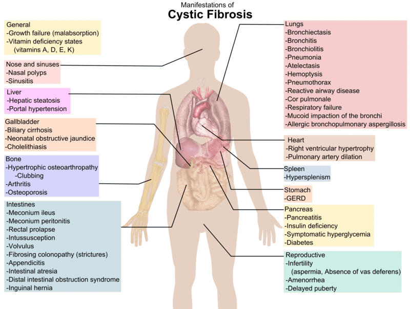 http://files.differencebetween.com/wp-content/uploads/2015/08/Difference-Between-Cystic-Fibrosis-and-Pulmonary-Fibrosis-cystic.png