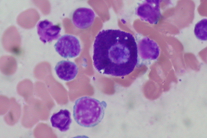 Key Difference -Giemsa Stain vs Wright Stain 