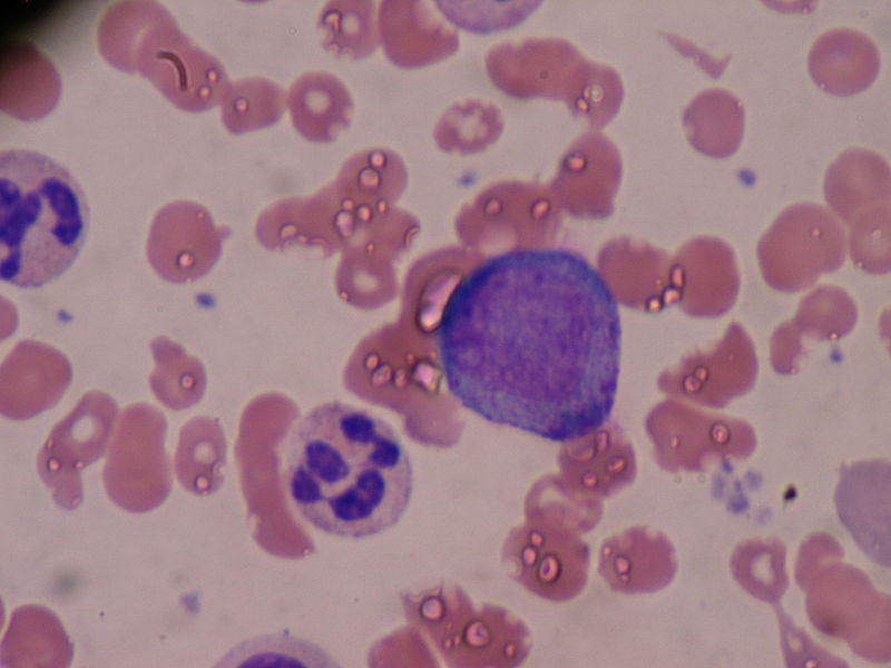 Difference Between Promyelocyte and Myelocyte