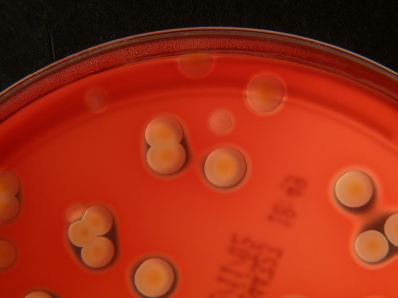 Key Difference Between Strep A and Strep B