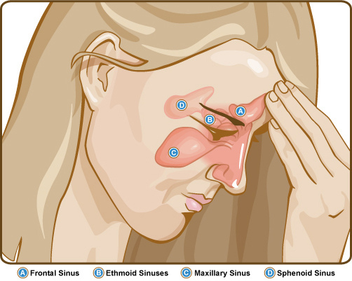 Difference Between Sinus Infection and Upper Respiratory Tract Infection 