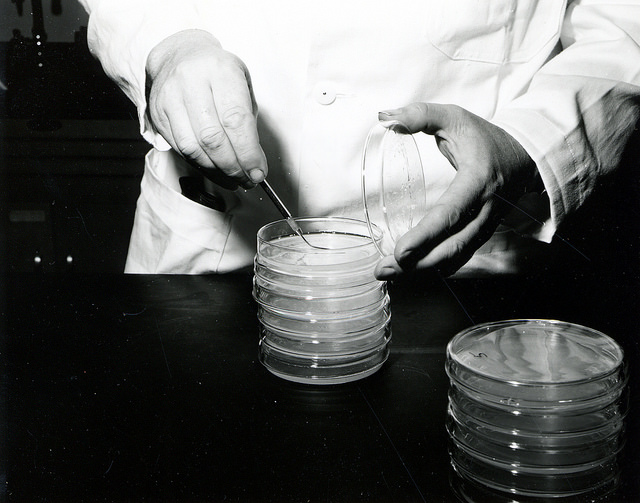 Key Difference Between Streak Plate and Spread Plate