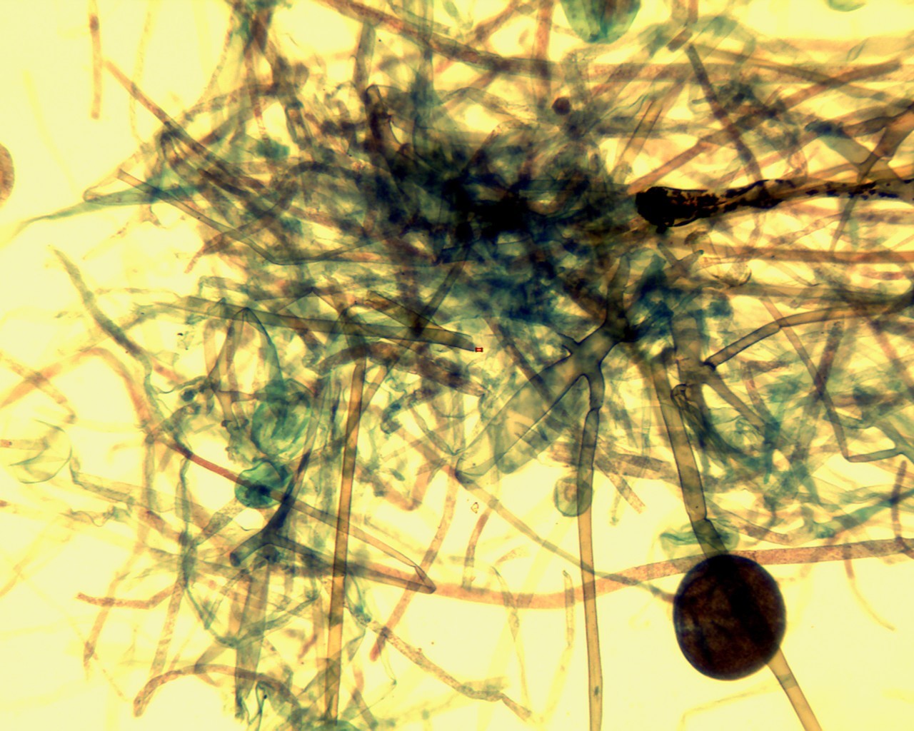 Key Difference - Mucor vs Rhizopus