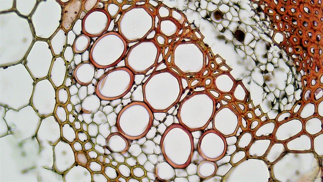 Difference Between Primary Xylem and Secondary Xylem