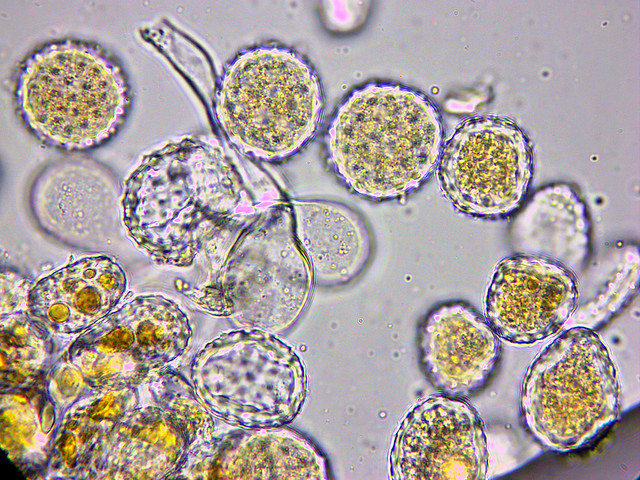 Difference Between Uredospore and Teliospore