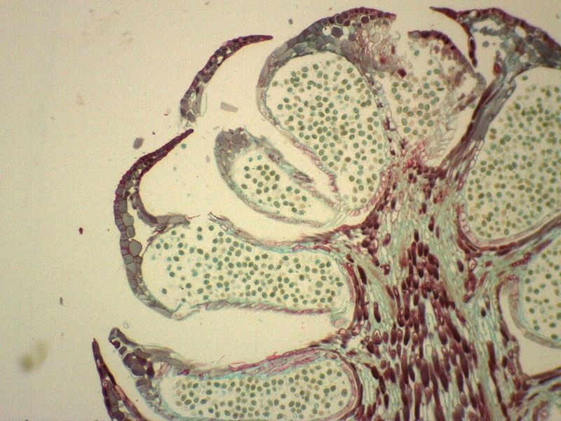 Difference Between Male and Female Gametophyte