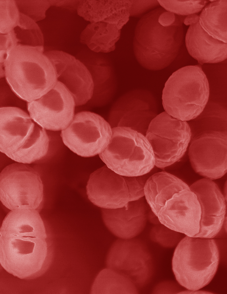 Homofermentative Bacteria Example - Lactococcus Lactis